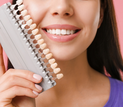 Porcelain Veneers in Athens