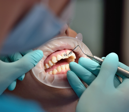Cosmetic Dentistry specialist in Athens: Dr. Kasouhas