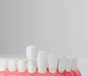 Dental Clinic in Athens - Dr. Kasouhas